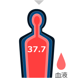30分：深部体温 38.3℃